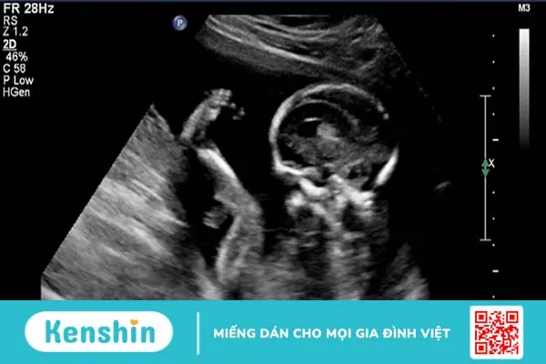 Siêu âm 2D: Khi nào mẹ bầu cần áp dụng trong thai kỳ?