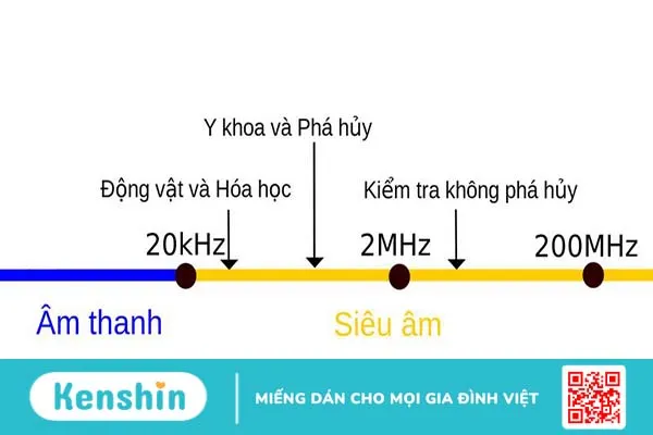 Siêu âm động mạch cảnh: Quy trình và các trường hợp cần thực hiện