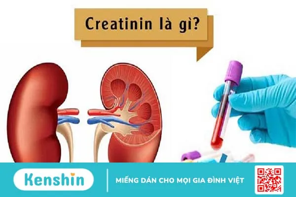 Sinh hóa creatinin máu là gì? Nồng độ creatinin bao nhiêu là bình thường?