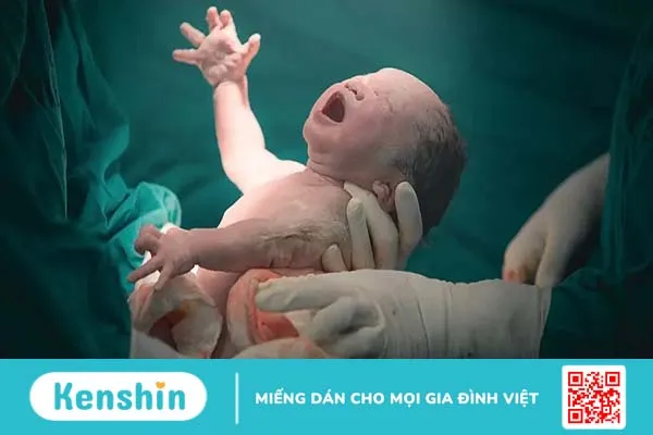 Sinh thường và sinh mổ cái nào đau hơn?