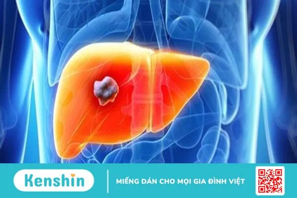 Tại sao giun chui ống mật?