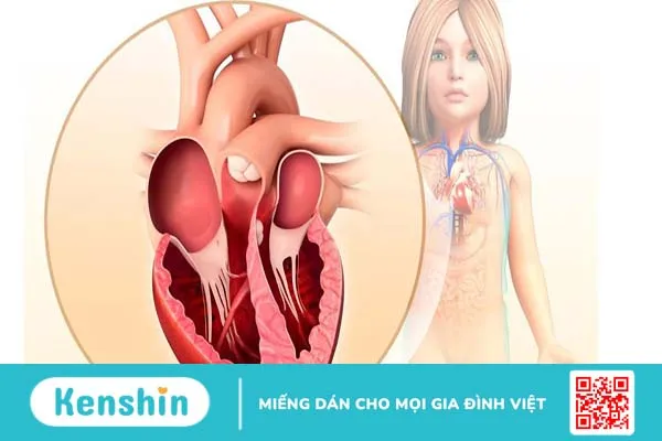 Tâm nhĩ là gì? Các bệnh lý thường gặp ở tâm nhĩ