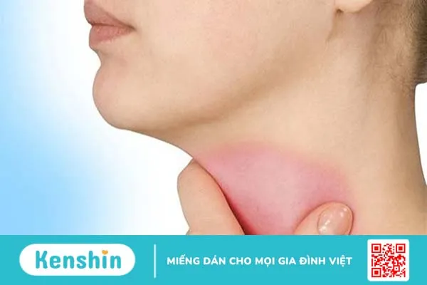 Tất cả thông tin về bướu cổ bên phải mà bạn không thể bỏ lỡ