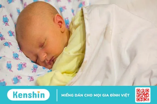 Thay máu là gì? Những thông tin về điều trị bệnh vàng da ở trẻ nhỏ