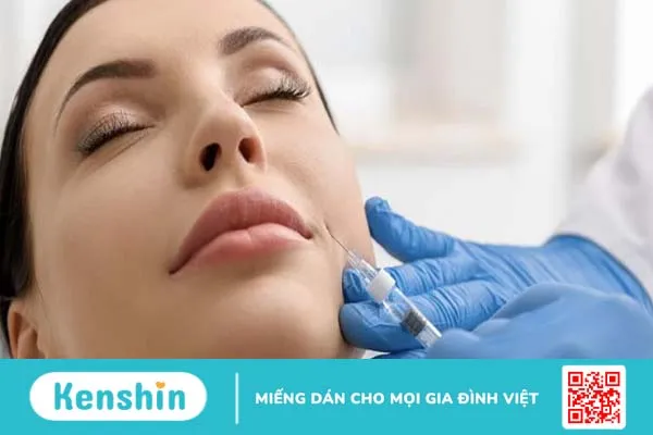 Tiêm rãnh cười bị đơ và những điều cần biết