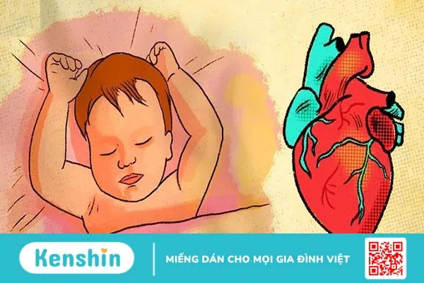 Tìm hiểu chi tiết về dị tật bẩm sinh tâm thất độc nhất