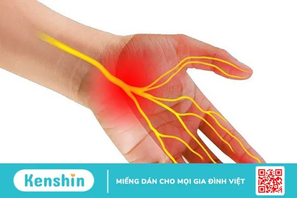 Tìm hiểu CTS là gì? Biện pháp chẩn đoán hội chứng CTS phổ biến nhất