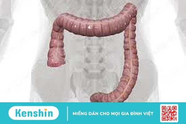 Tìm hiểu giải phẫu đại tràng, chức năng và các bệnh lý xảy ra tại đại tràng