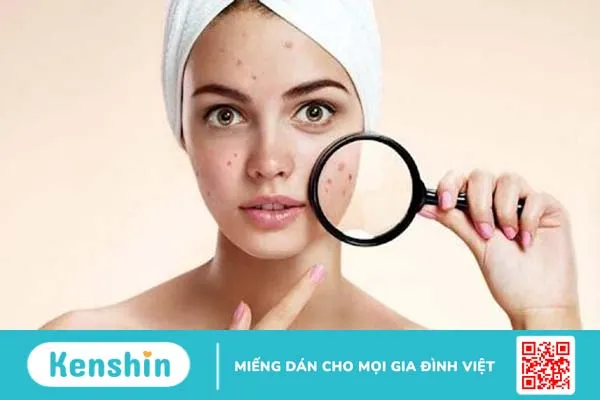 Tìm hiểu nguyên nhân dùng sữa rửa mặt bị nổi mụn