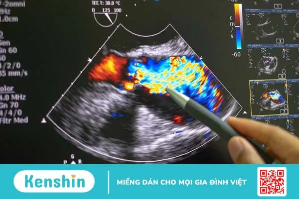 Tìm hiểu về các chỉ số đánh giá chức năng của tim