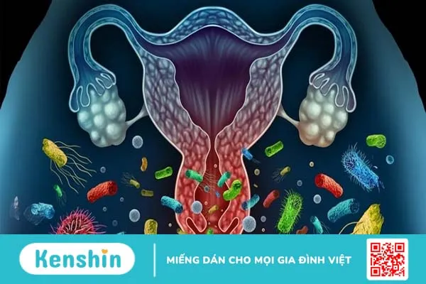 Tìm hiểu về đặc điểm của Gardnerella là gì? Gardnerella gây ra những biến chứng gì?