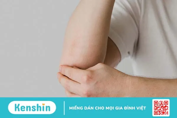 Tình trạng nổi hạch ở khuỷu tay cảnh báo bệnh gì? Phương pháp điều trị