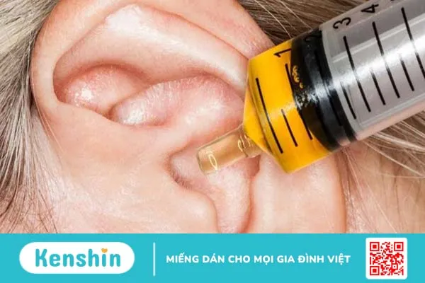 Tổng quan phác đồ điều trị viêm tai giữa mạn tính và cấp tính