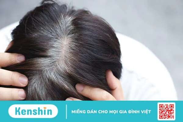 Trẻ em tóc bạc sớm khám ở đâu? Gợi ý những địa chỉ uy tín tại Hà Nội và TP.HCM