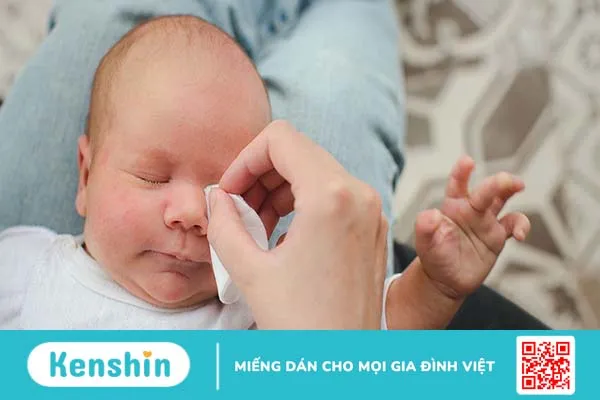 Trẻ sơ sinh bị đau mắt làm thế nào cho mau khỏi?