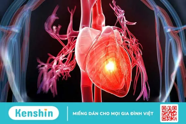 Trụy mạch là gì? Nguyên nhân, triệu chứng và cách phòng ngừa