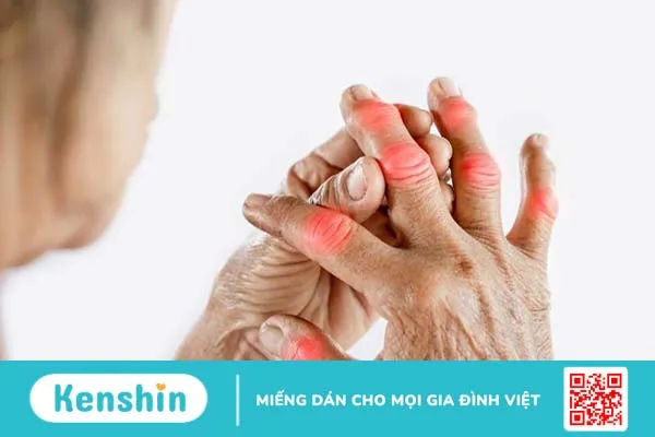 Viêm đa khớp có di truyền không? Điều trị như thế nào?