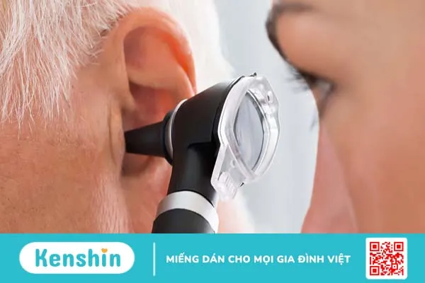 Viêm tai giữa mạn tính có cholesteatoma là gì? Triệu chứng và cách điều trị