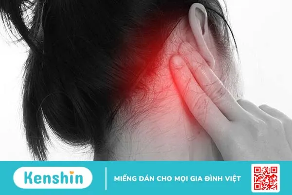 Viêm tai xương chũm có cholesteatoma là gì? Cách điều trị ra sao