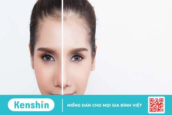 Vitamin C có thực sự giúp làm trắng da?