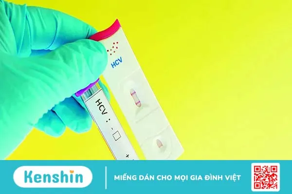 Xét nghiệm Anti HCV tìm kháng thể chống virus viêm gan C