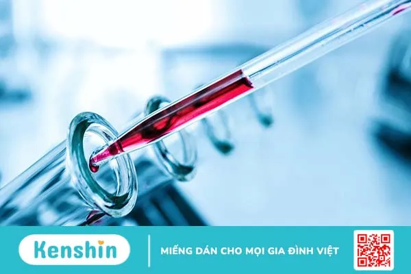 Xét nghiệm H. pylori IgG cho kết quả dương tính có ý nghĩa gì?