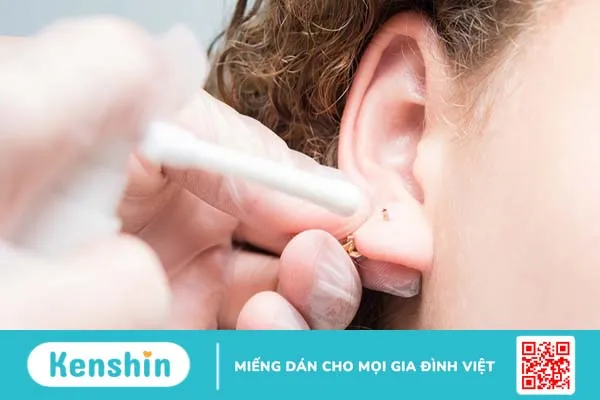 Xỏ khuyên có nên bôi thuốc mỡ không?