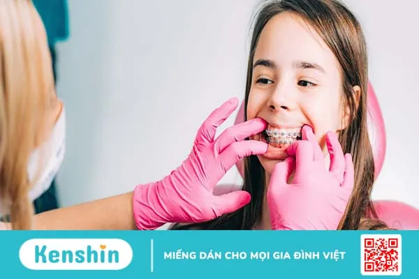 Xương hàm mỏng có niềng răng được không?