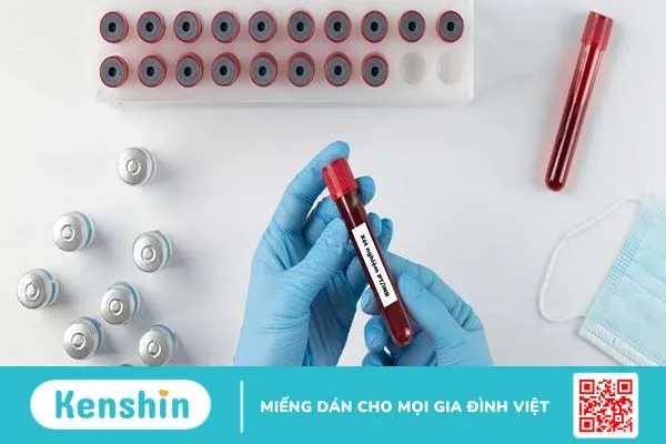 Ý nghĩa lâm sàng kết quả xét nghiệm chỉ số INR